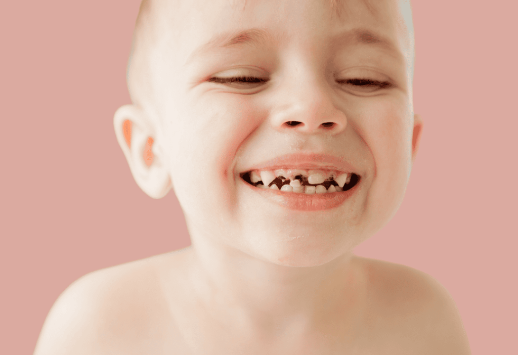caries-infantil